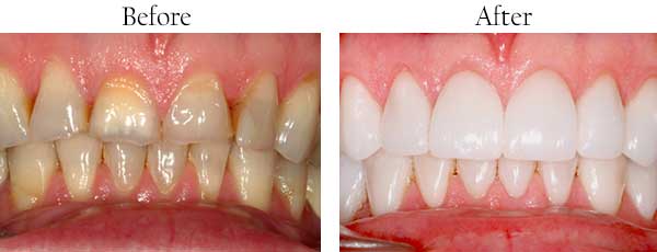 dental images 92071
